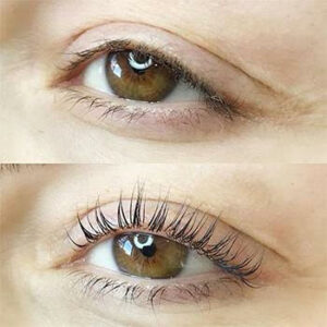 Lash botox